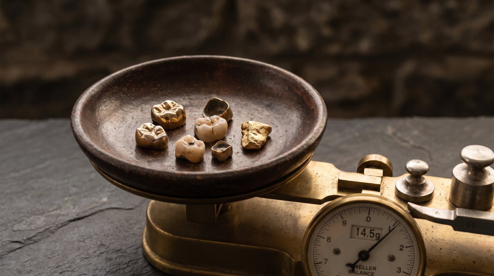 Quelle est la valeur de l’or dentaire ?